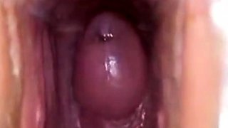 Girl's Tiring Doctor Visit A Webcam Capture