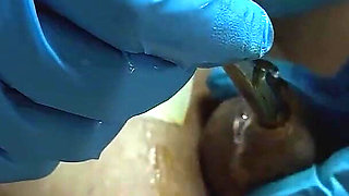 Hospital 3 - Patient Admission